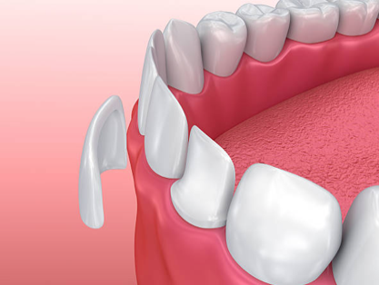 Estetica Dentale
